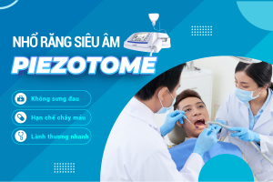 NHỔ RĂNG KHÔNG ĐAU PIEZOTOME – XÓA BỎ NỖI LO ĐAU RĂNG