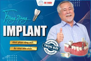 Trồng răng implant uy tín tại Đà Nẵng | Địa chỉ được KH đánh giá cao