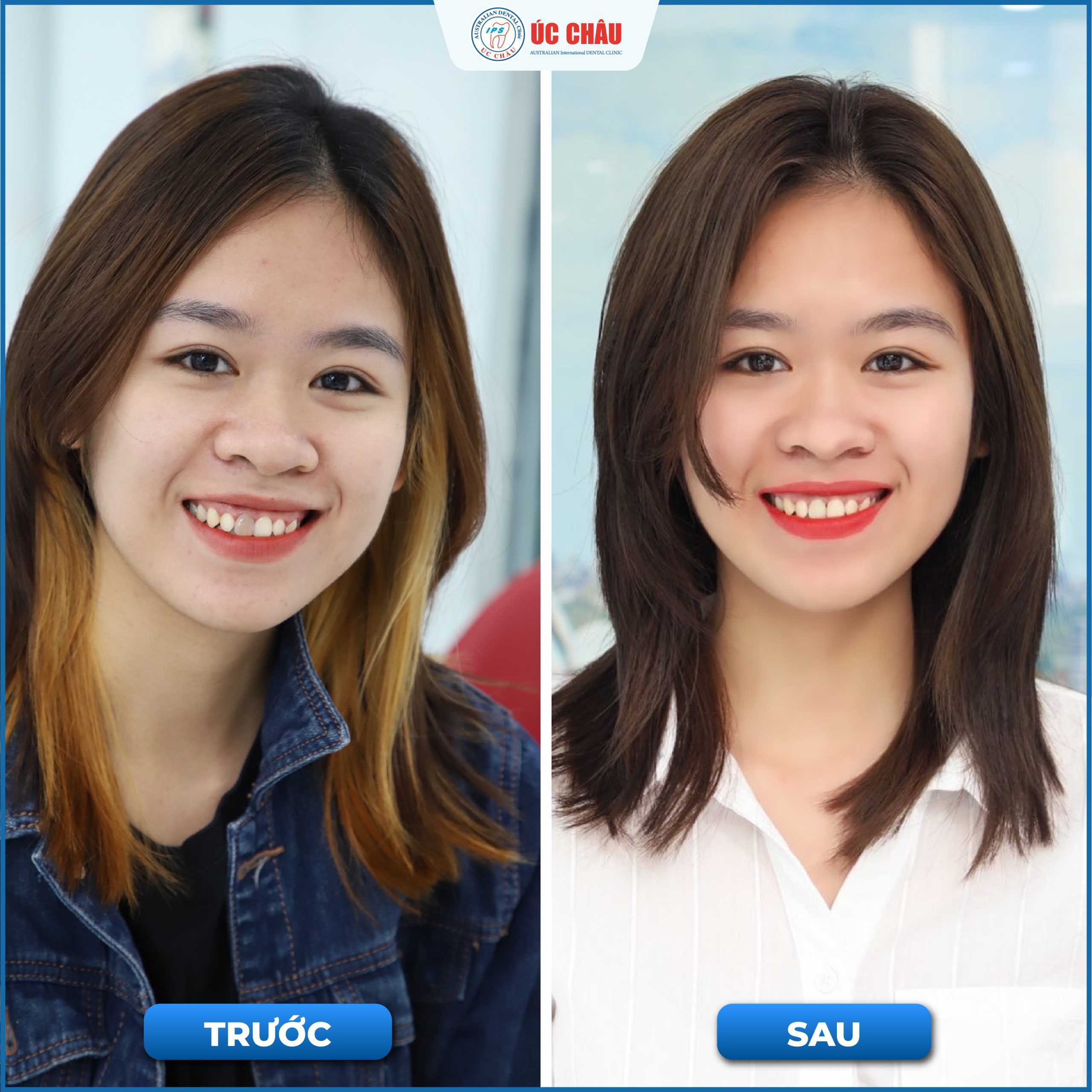 Lich-su-phat-trien-nha-khoa