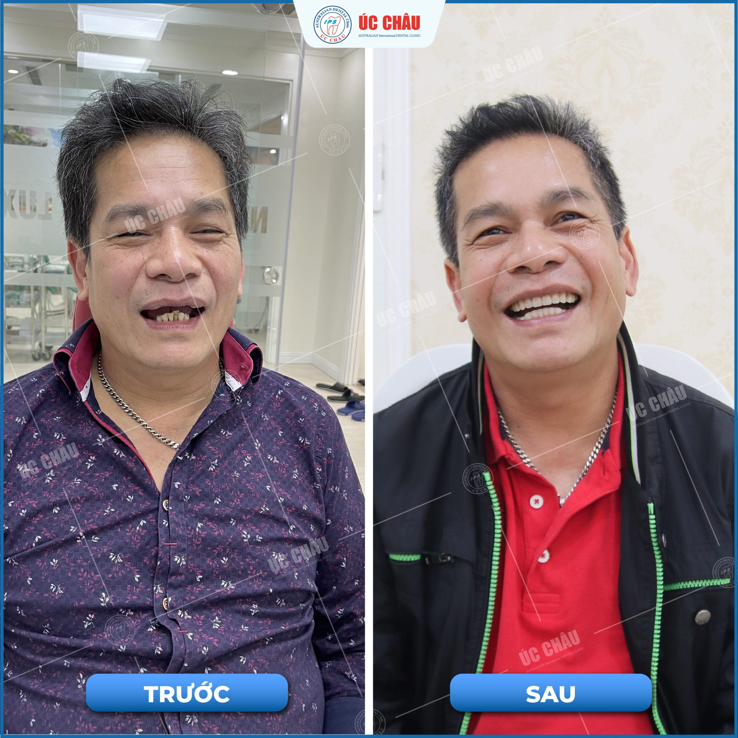 Lich-su-phat-trien-nha-khoa