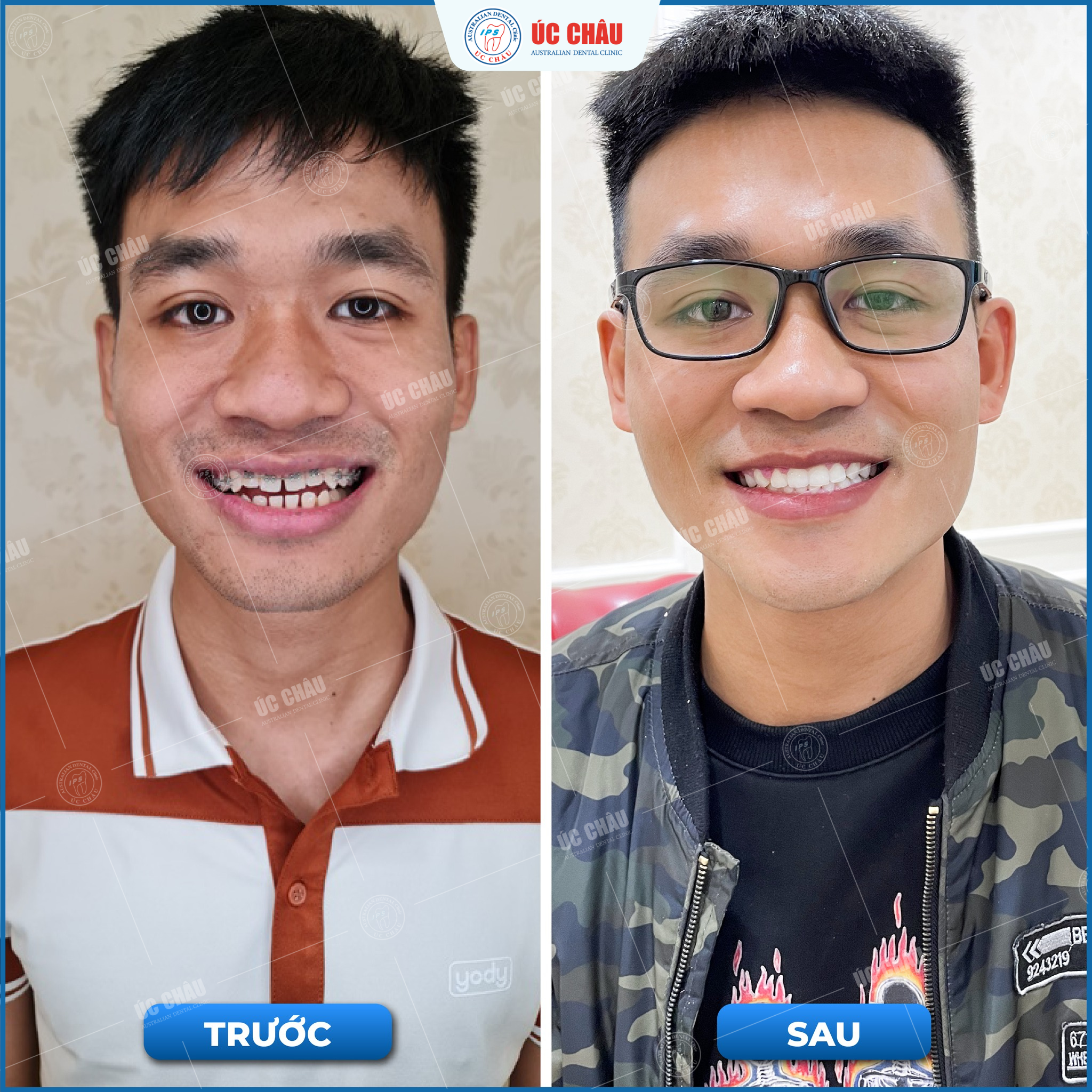 trung-tam-nieng-rang-o-da-nang