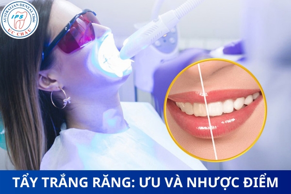 gia-tien-tay-trang-rang-o-da-nang