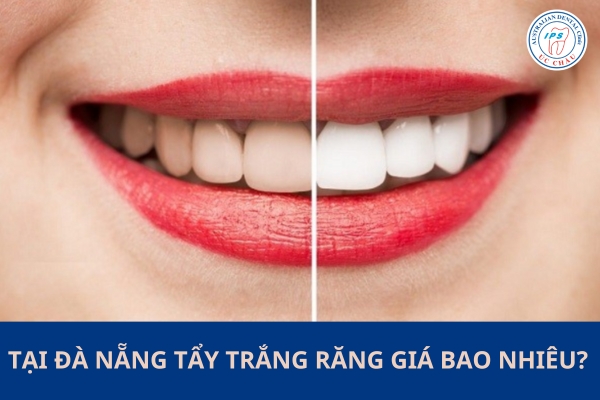 tay-trang-rang-o-da-nang