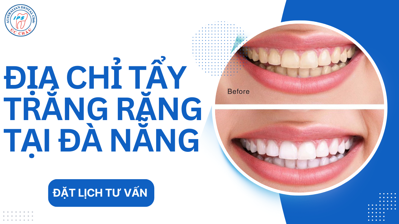 dia-chi-tay-trang-rang-tai-da-nang